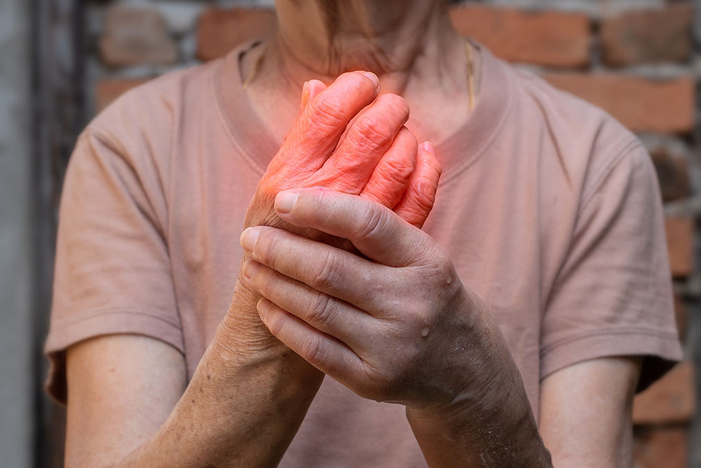 Read more about the article Vertigo And Gout: Weird Connection